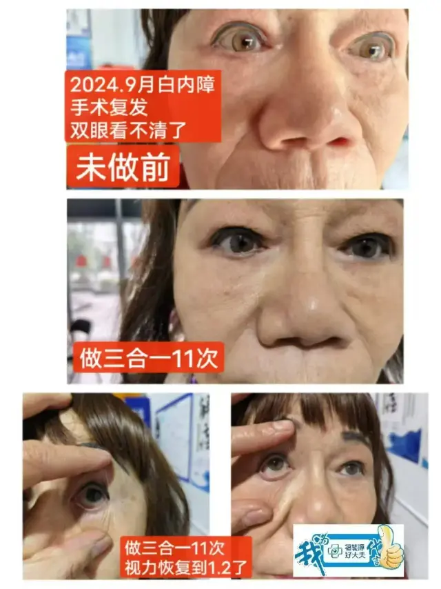 眼部调理 近视 远视 源头厂家-2