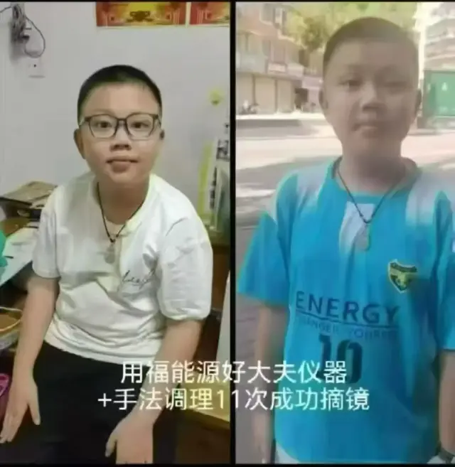 眼部调理 近视 远视 源头厂家-3
